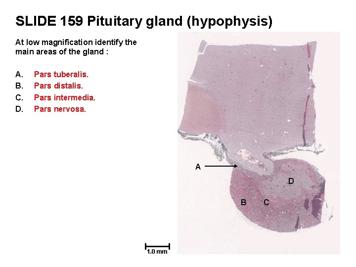 SLIDE 159 Pituitary gland (hypophysis) At low magnification identify the main areas of the