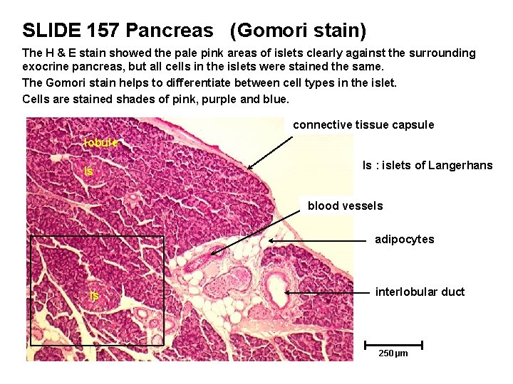 SLIDE 157 Pancreas (Gomori stain) The H & E stain showed the pale pink