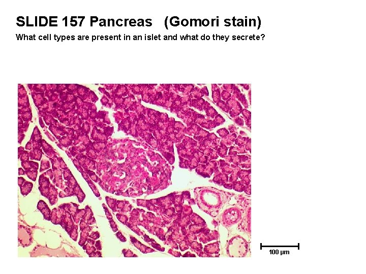 SLIDE 157 Pancreas (Gomori stain) What cell types are present in an islet and