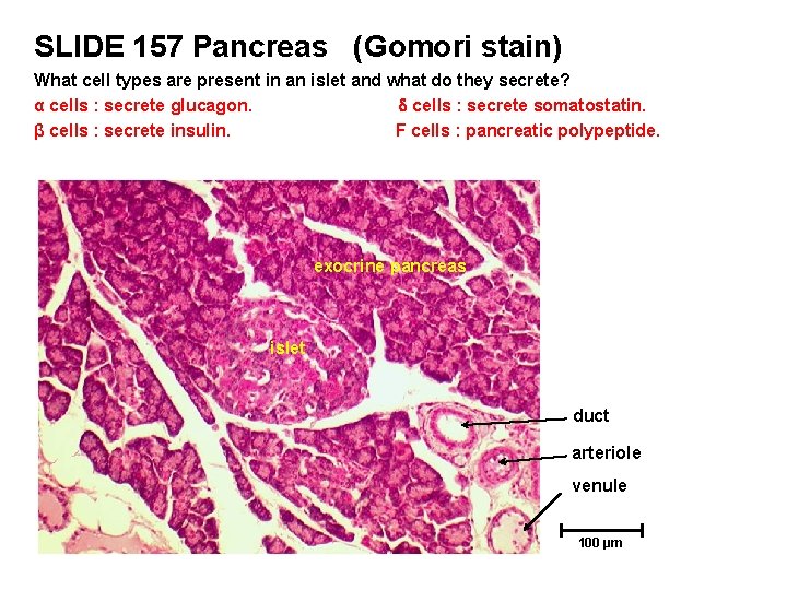 SLIDE 157 Pancreas (Gomori stain) What cell types are present in an islet and