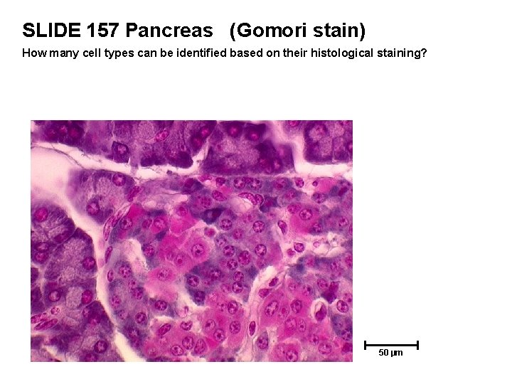 SLIDE 157 Pancreas (Gomori stain) How many cell types can be identified based on