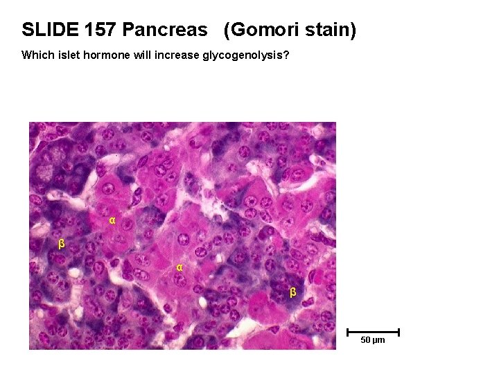 SLIDE 157 Pancreas (Gomori stain) Which islet hormone will increase glycogenolysis? α β 50