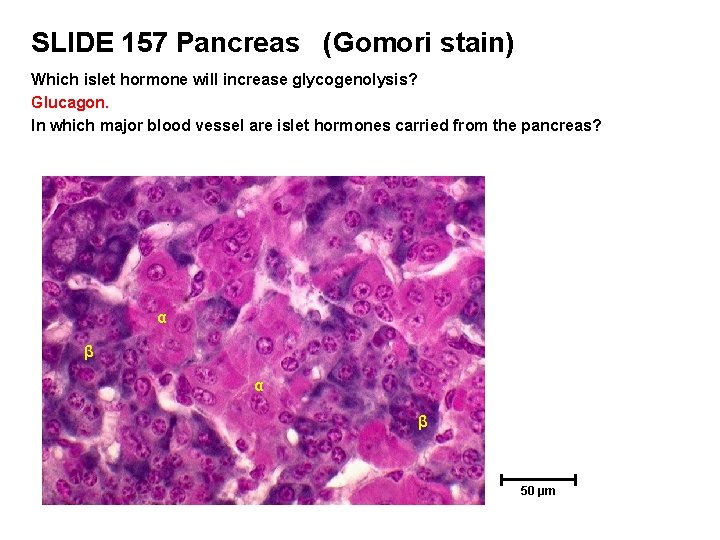 SLIDE 157 Pancreas (Gomori stain) Which islet hormone will increase glycogenolysis? Glucagon. In which