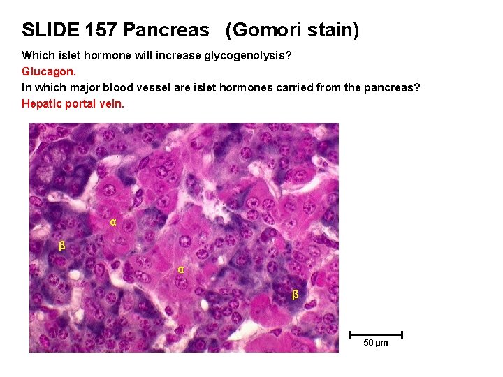 SLIDE 157 Pancreas (Gomori stain) Which islet hormone will increase glycogenolysis? Glucagon. In which