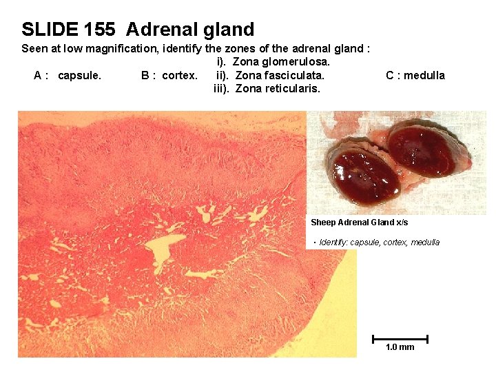 SLIDE 155 Adrenal gland Seen at low magnification, identify the zones of the adrenal
