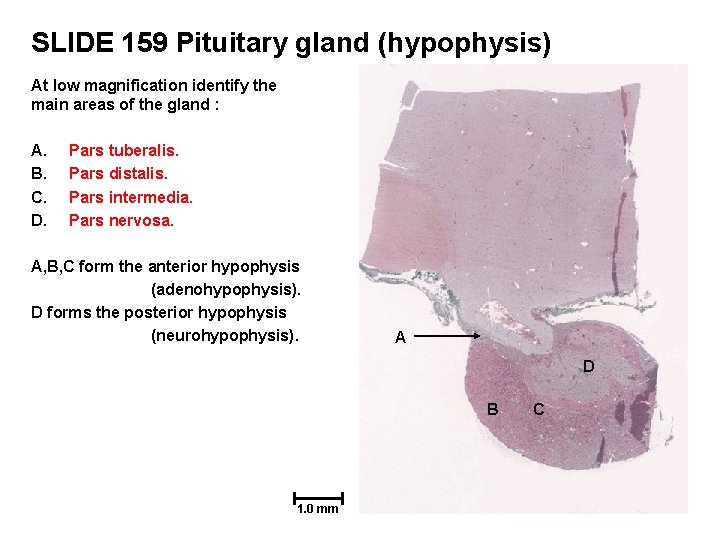 SLIDE 159 Pituitary gland (hypophysis) At low magnification identify the main areas of the
