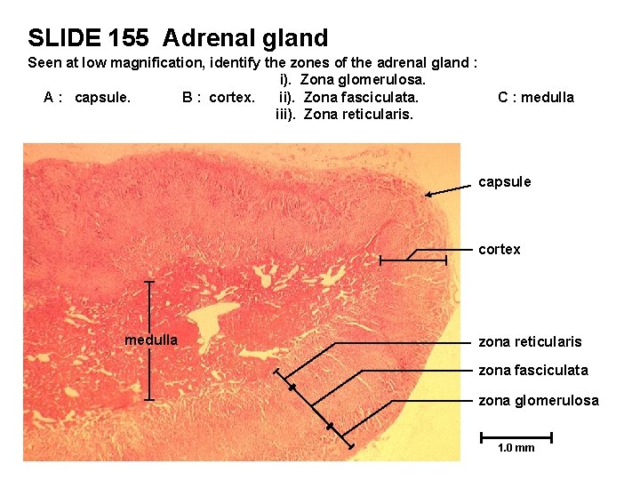 SLIDE 155 Adrenal gland Seen at low magnification, identify the zones of the adrenal