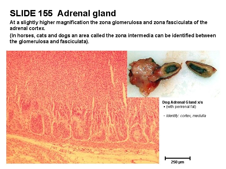 SLIDE 155 Adrenal gland At a slightly higher magnification the zona glomerulosa and zona