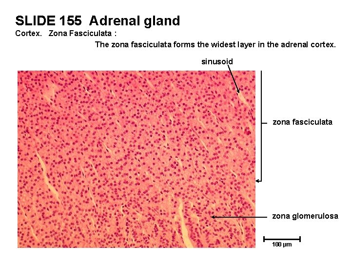 SLIDE 155 Adrenal gland Cortex. Zona Fasciculata : The zona fasciculata forms the widest