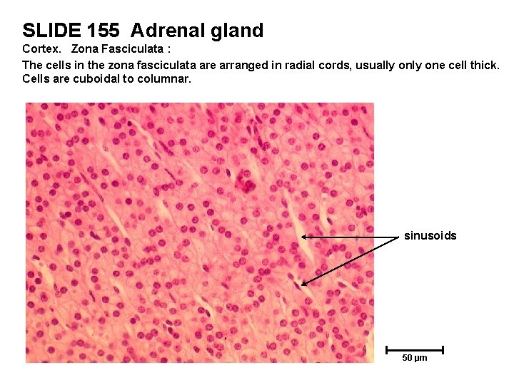 SLIDE 155 Adrenal gland Cortex. Zona Fasciculata : The cells in the zona fasciculata