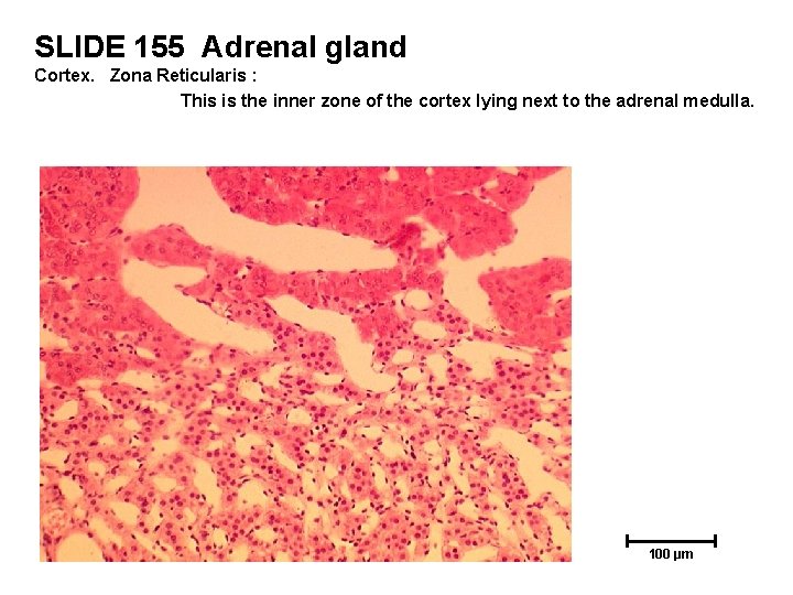SLIDE 155 Adrenal gland Cortex. Zona Reticularis : This is the inner zone of