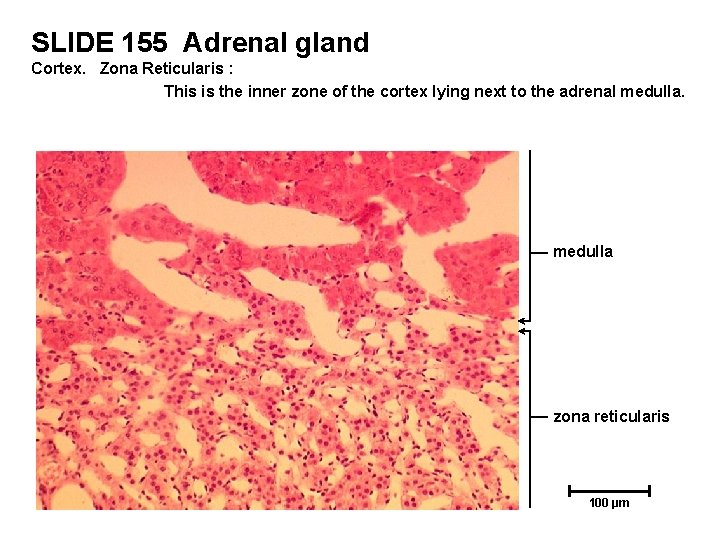 SLIDE 155 Adrenal gland Cortex. Zona Reticularis : This is the inner zone of