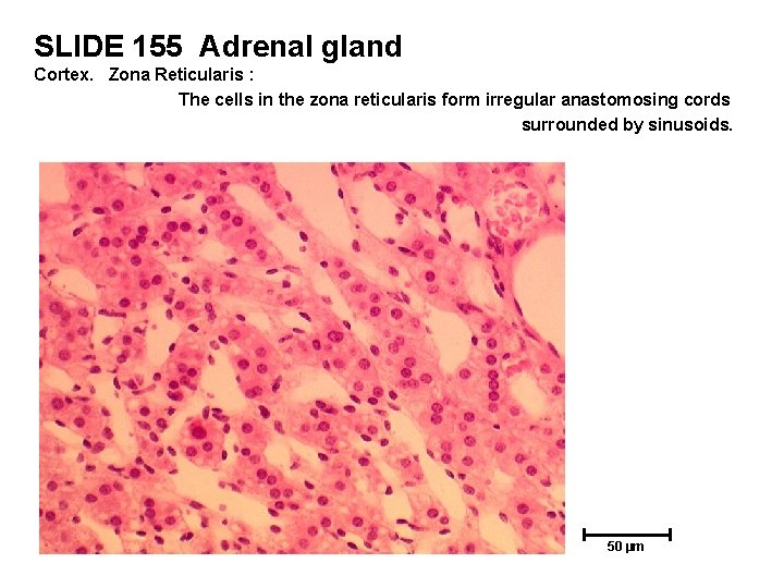 SLIDE 155 Adrenal gland Cortex. Zona Reticularis : The cells in the zona reticularis