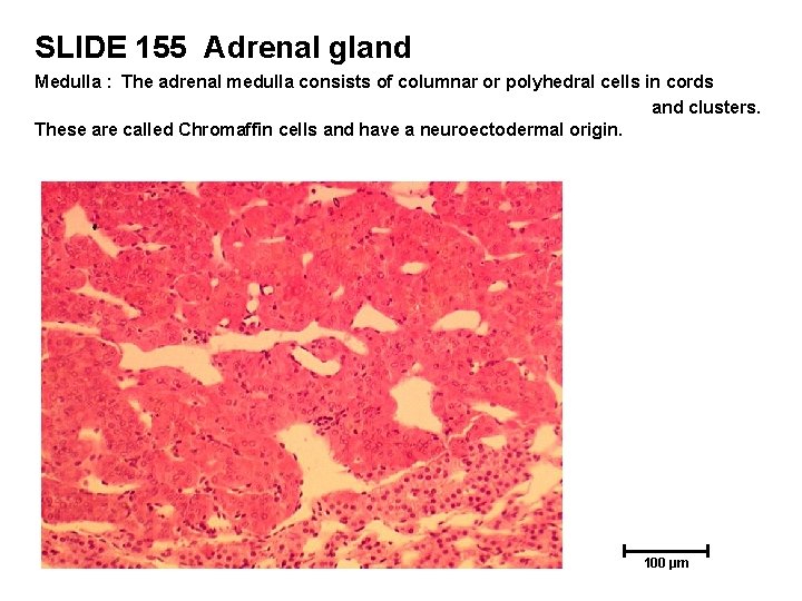 SLIDE 155 Adrenal gland Medulla : The adrenal medulla consists of columnar or polyhedral