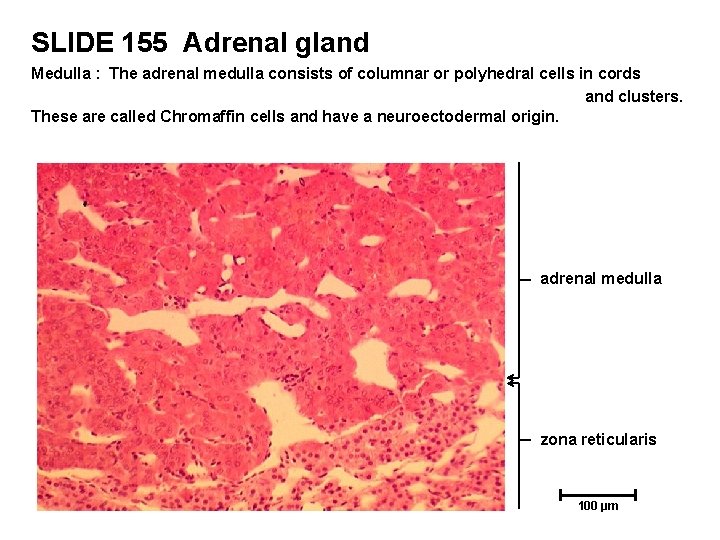 SLIDE 155 Adrenal gland Medulla : The adrenal medulla consists of columnar or polyhedral