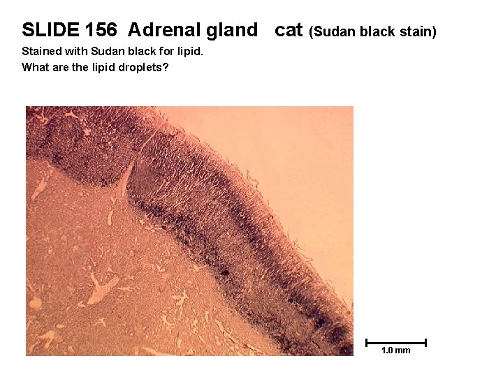 SLIDE 156 Adrenal gland cat (Sudan black stain) Stained with Sudan black for lipid.