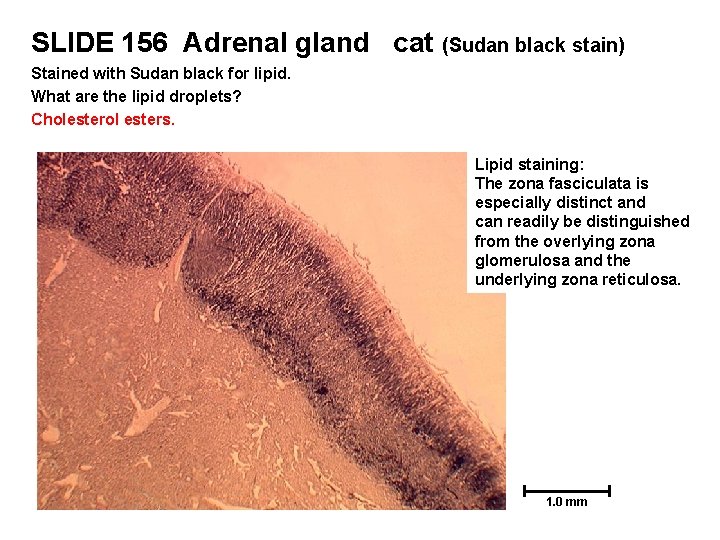 SLIDE 156 Adrenal gland cat (Sudan black stain) Stained with Sudan black for lipid.