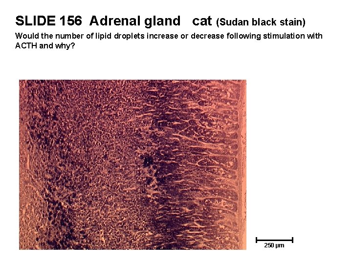 SLIDE 156 Adrenal gland cat (Sudan black stain) Would the number of lipid droplets