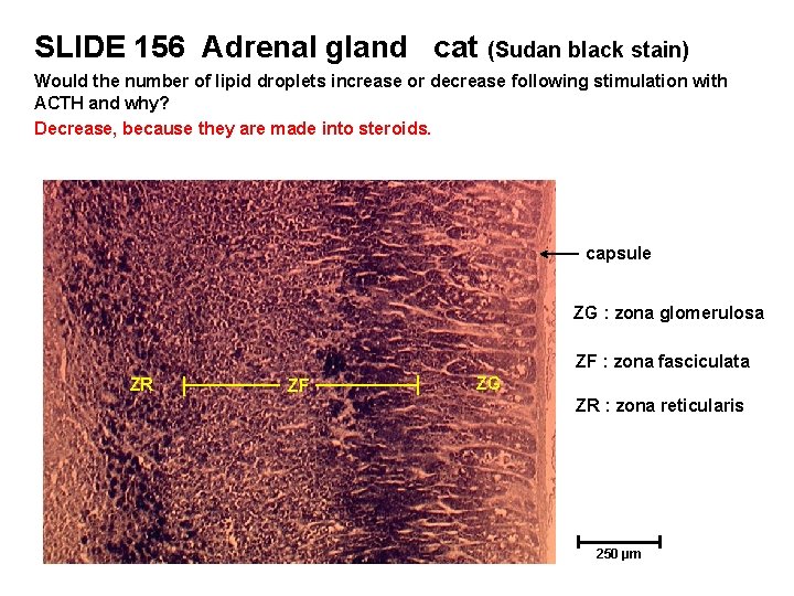 SLIDE 156 Adrenal gland cat (Sudan black stain) Would the number of lipid droplets