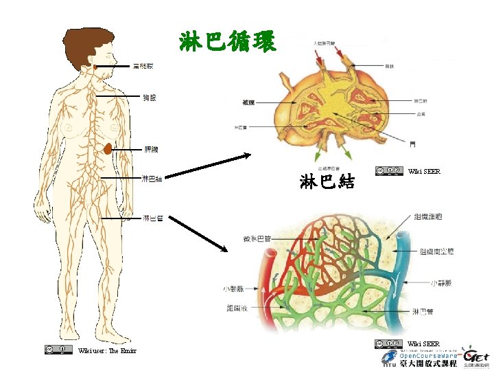 淋巴循環 淋巴結 Wiki user: The Emirr Wiki SEER 
