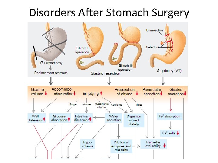 Disorders After Stomach Surgery 