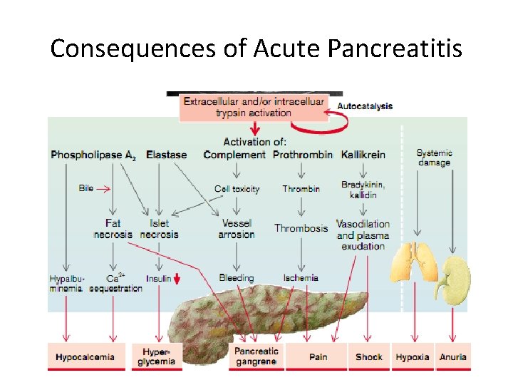 Consequences of Acute Pancreatitis 