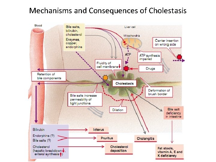 Mechanisms and Consequences of Cholestasis 