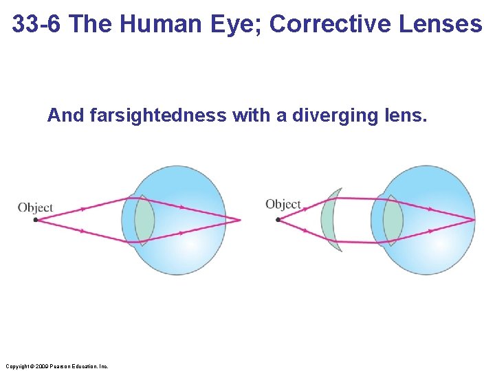 33 -6 The Human Eye; Corrective Lenses And farsightedness with a diverging lens. Copyright