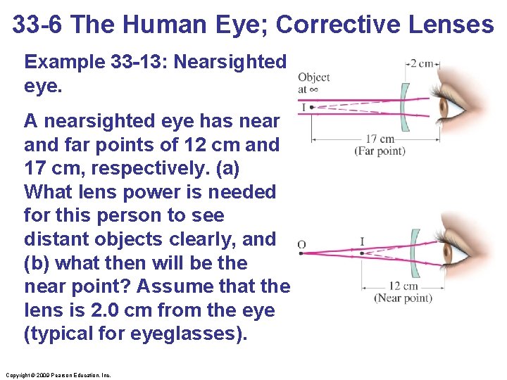33 -6 The Human Eye; Corrective Lenses Example 33 -13: Nearsighted eye. A nearsighted