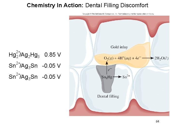 Chemistry In Action: Dental Filling Discomfort 2+ Hg 2 /Ag 2 Hg 3 0.
