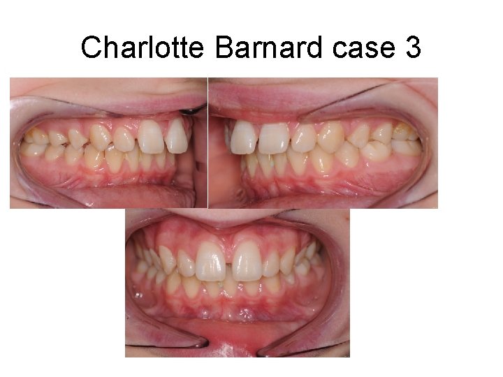 Charlotte Barnard case 3 Charlotte Barnard case 3