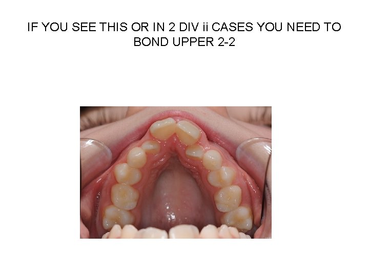 IF YOU SEE THIS OR IN 2 DIV ii CASES YOU NEED TO BOND IF YOU SEE THIS OR IN 2 DIV ii CASES YOU NEED TO BOND