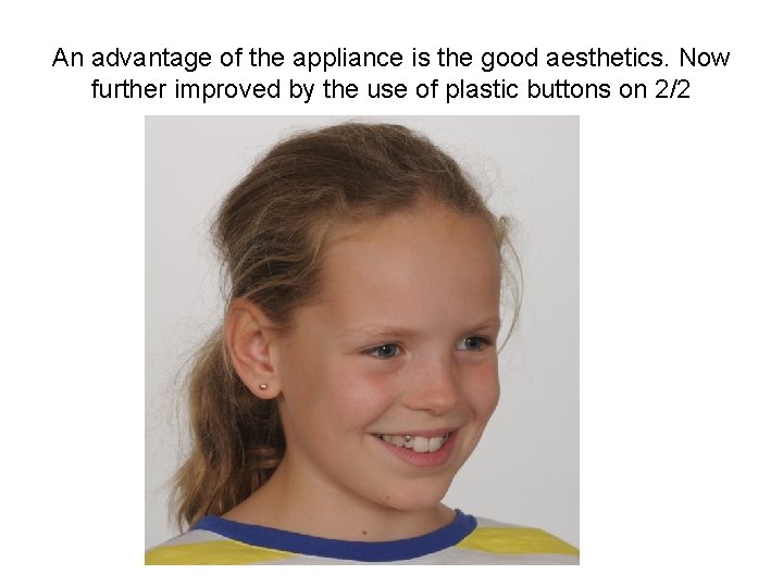 An advantage of the appliance is the good aesthetics. Now further improved by the An advantage of the appliance is the good aesthetics. Now further improved by the