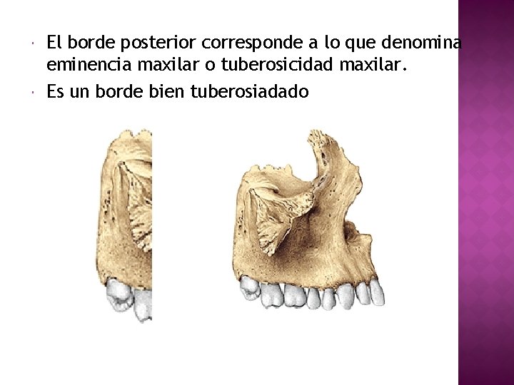  El borde posterior corresponde a lo que denomina eminencia maxilar o tuberosicidad maxilar.