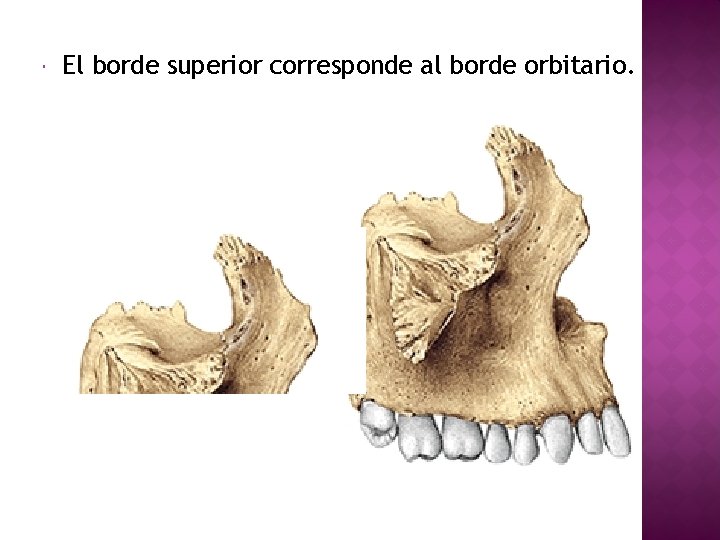  El borde superior corresponde al borde orbitario. 