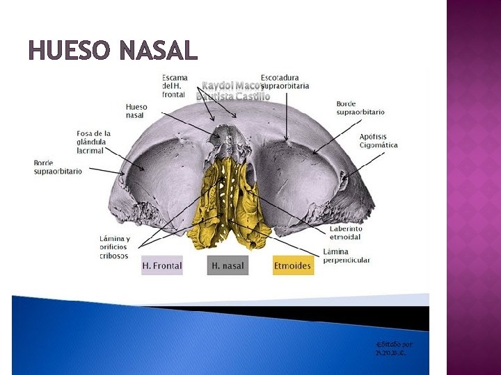 HUESO NASAL 