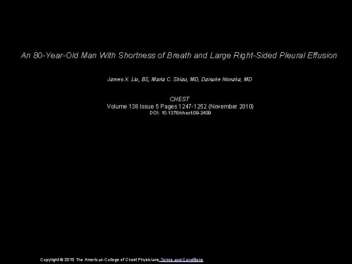 An 80 -Year-Old Man With Shortness of Breath and Large Right-Sided Pleural Effusion James