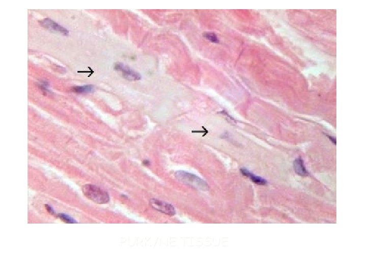 PURKYNE TISSUE 
