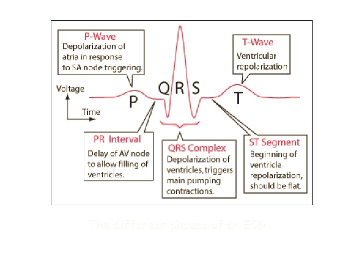 The different phases of an ECG 