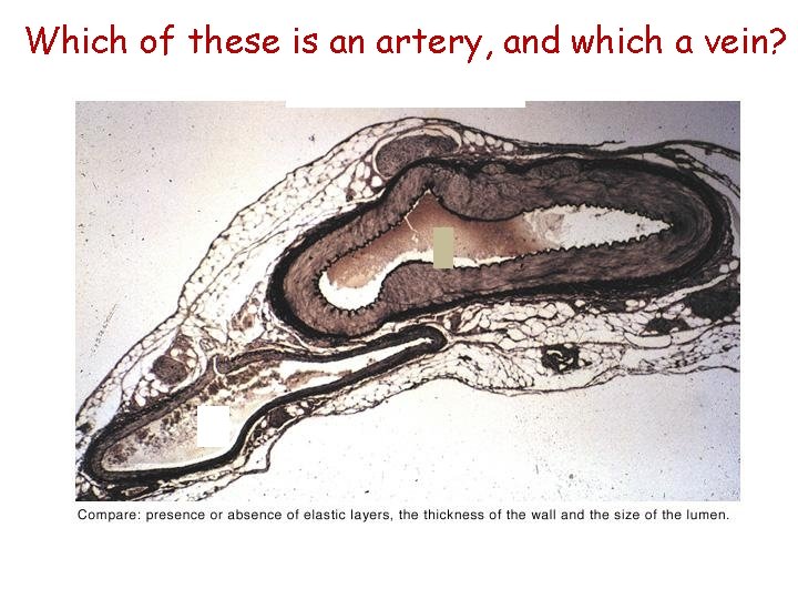 Which of these is an artery, and which a vein? 