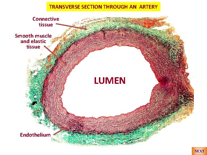 TRANSVERSE SECTION THROUGH AN ARTERY Connective tissue Smooth muscle and elastic tissue LUMEN Endothelium