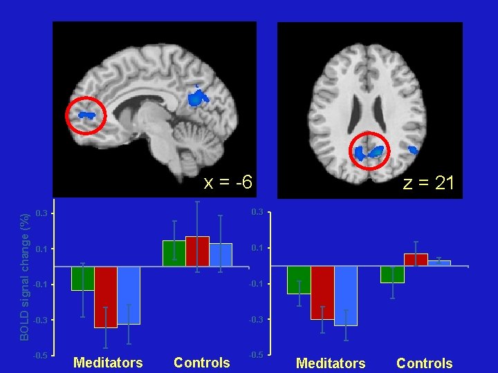 BOLD signal change (%) x = -6 0. 3 0. 1 -0. 3 -0.