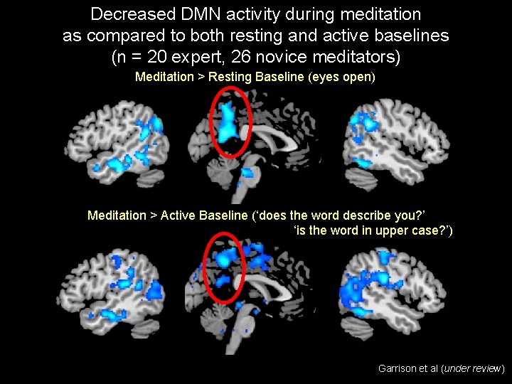 Decreased DMN activity during meditation as compared to both resting and active baselines (n