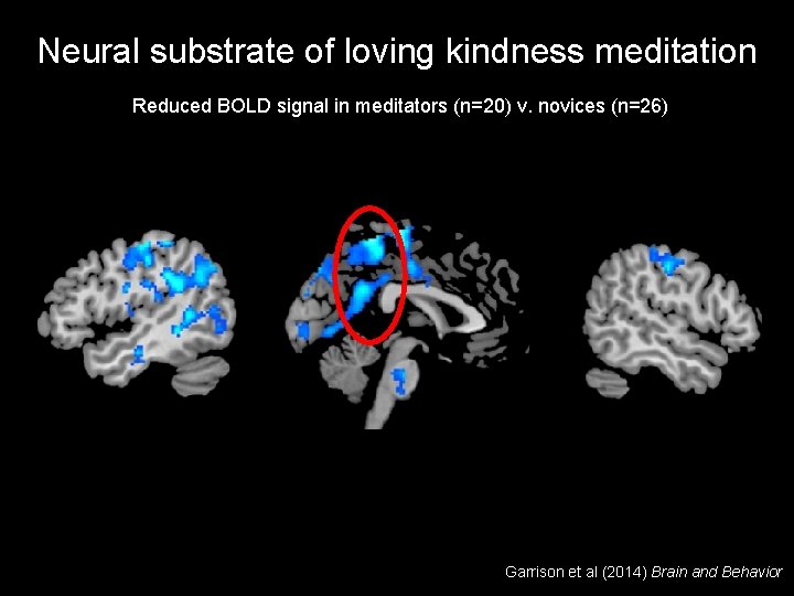 Neural substrate of loving kindness meditation Reduced BOLD signal in meditators (n=20) v. novices