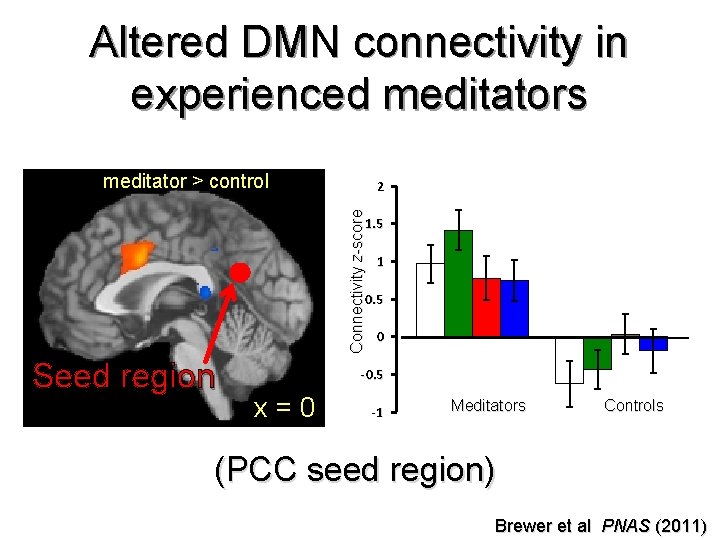 Altered DMN connectivity in experienced meditators meditator > control Connectivity z-score 2 1. 5