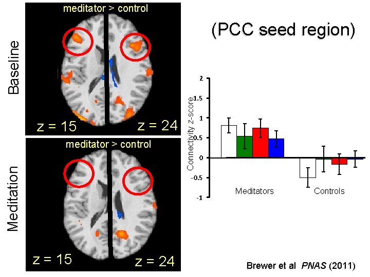 meditator > control Baseline (PCC seed region) 2 z = 15 z = 24