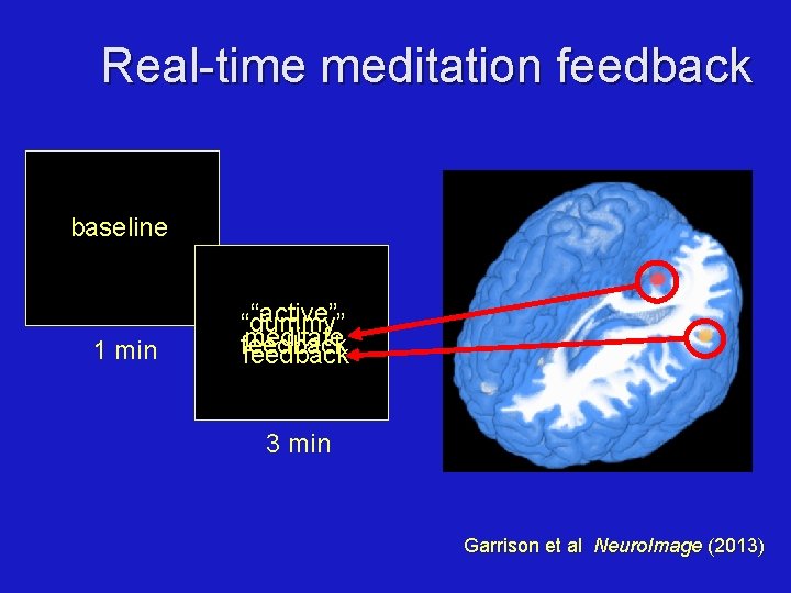 Real-time meditation feedback baseline 1 min “active” “dummy” meditate feedback 3 min Garrison et