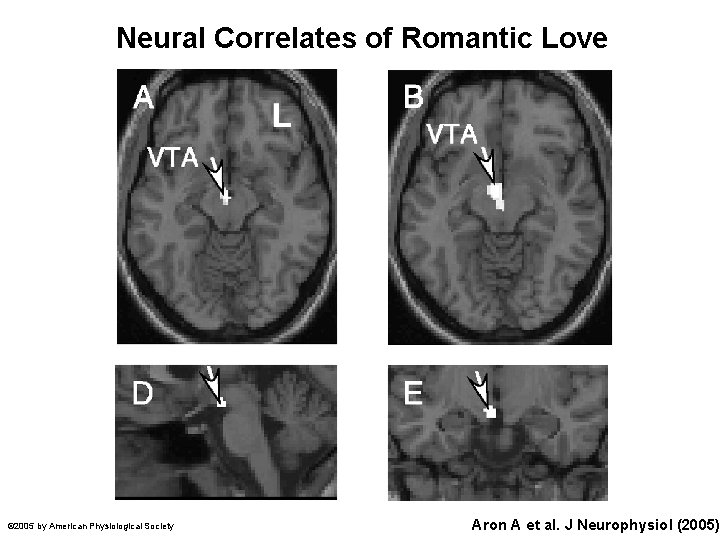 Neural Correlates of Romantic Love © 2005 by American Physiological Society Aron A et