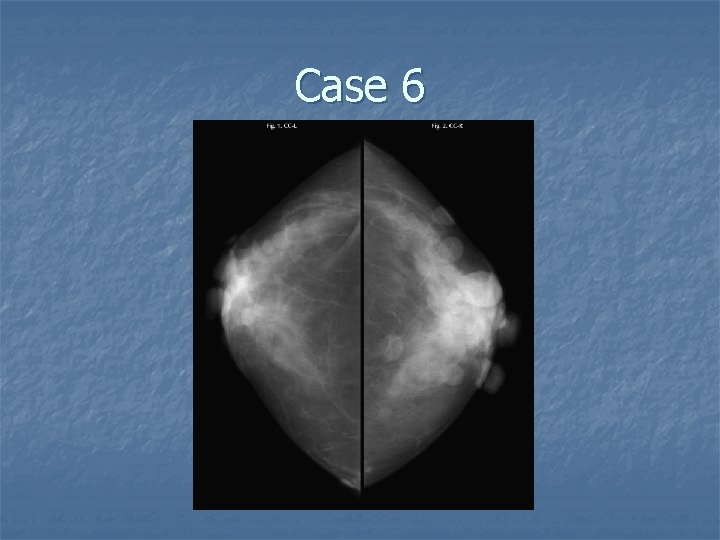 Case 6 