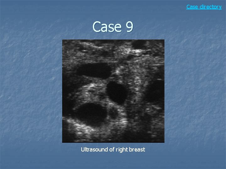 Case directory Case 9 Ultrasound of right breast 